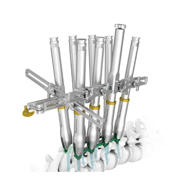 Sistema de Tornillos Pediculares para Columna Vertebral con Reducción de Desrotación TINA