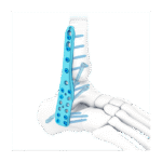 Imagen anterior del producto