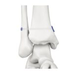 Imagen siguiente del producto