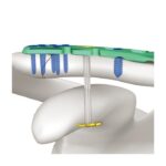 Imagen anterior del producto