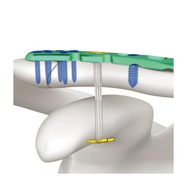 AC CFLOP AJUSTABLE BOTÓN Y SISTEMA DE PLACA