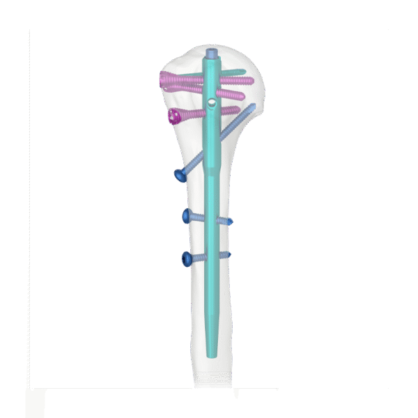 Clavo Humeral Avanzado