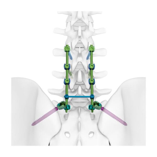 Sistema de Tornillos Pediculares para Columna Vertebral TINA