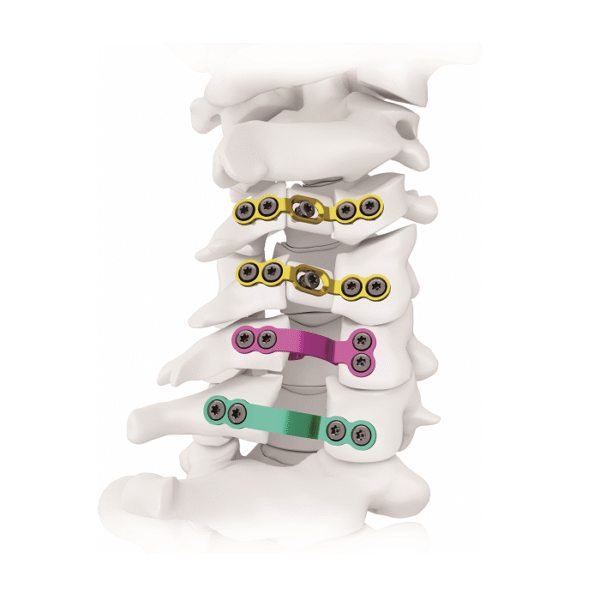Sistema de placas de laminoplastia II