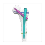 Imagen anterior del producto