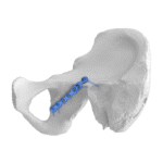 Imagen anterior del producto