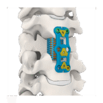 Imagen anterior del producto