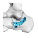 Imagen siguiente del producto