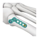 Imagen siguiente del producto