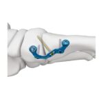 Imagen siguiente del producto