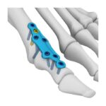 Imagen anterior del producto