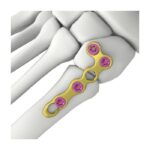 Imagen siguiente del producto