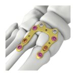 Imagen anterior del producto