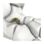 Imagen anterior del producto