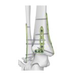 Imagen siguiente del producto