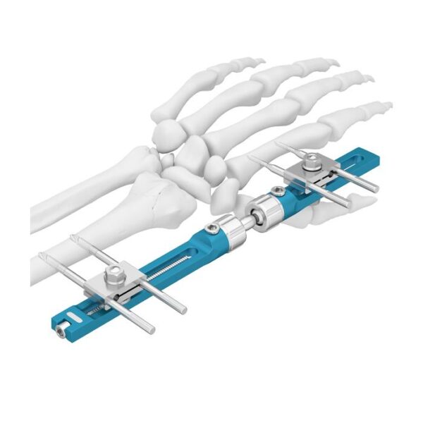 Fijador externo para muñeca y antebrazo