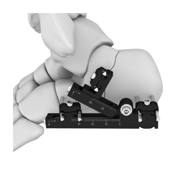 Fijador externo para calcaneus