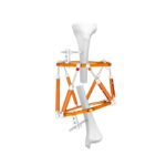 Imagen anterior del producto