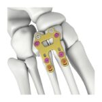 Imagen siguiente del producto