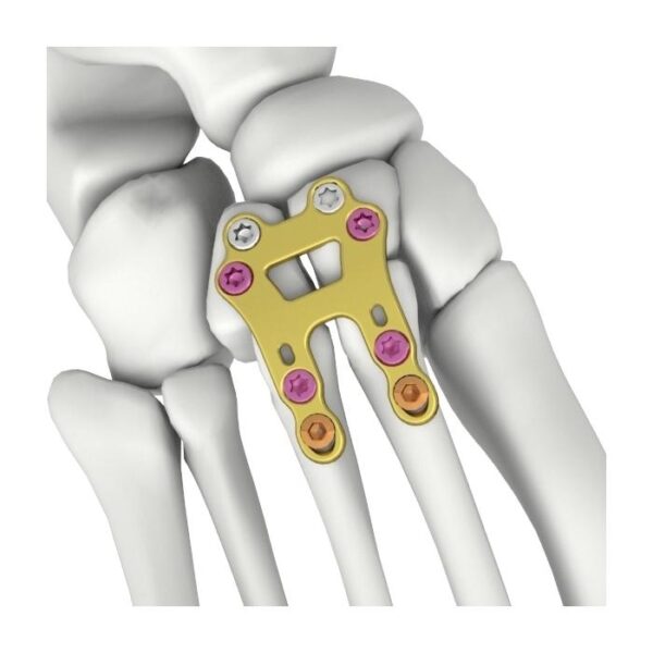 Placa de cierre rectangular itval