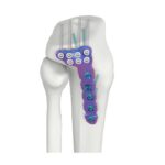 Imagen anterior del producto