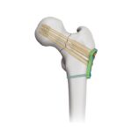 Imagen anterior del producto