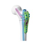 Imagen siguiente del producto