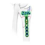 Imagen siguiente del producto