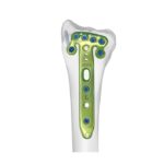 Imagen anterior del producto