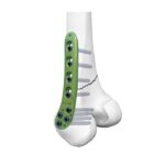 Imagen anterior del producto