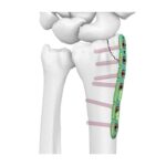 Imagen anterior del producto