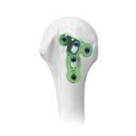 Imagen anterior del producto