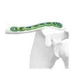 Imagen anterior del producto