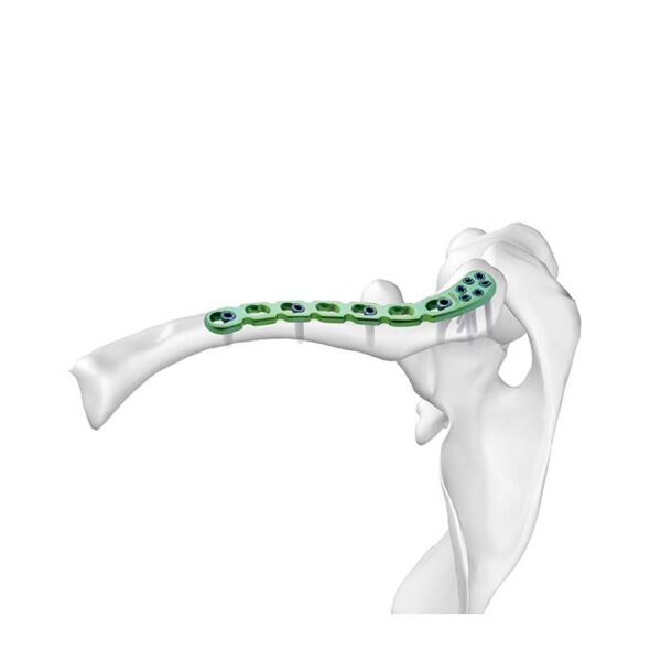 Placa Bloqueada Clavicular Distal I