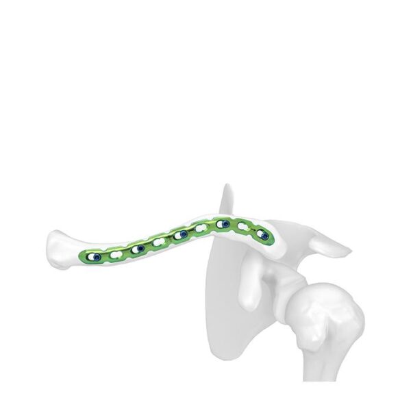 Placa Bloqueada Clavicular Superior Anterior Ⅱ