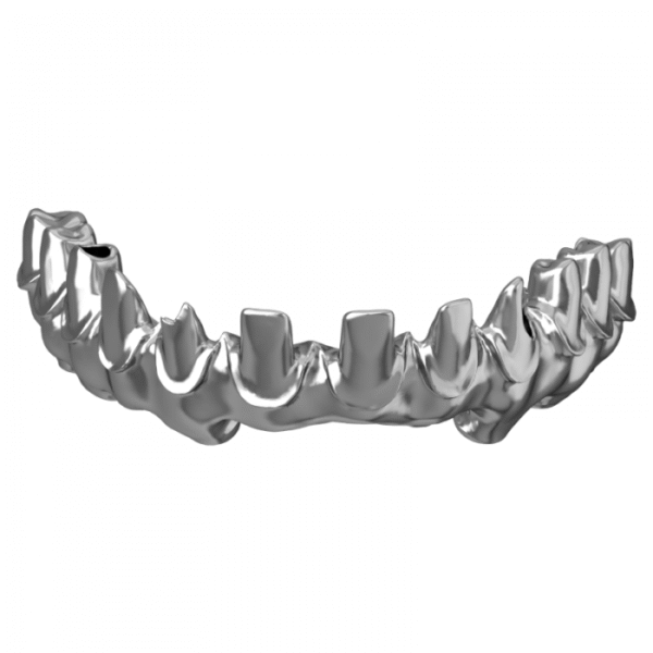Puente de implantes de titanio
